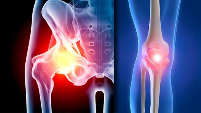 Hip and Knee Implants Market-4f9fc9a2