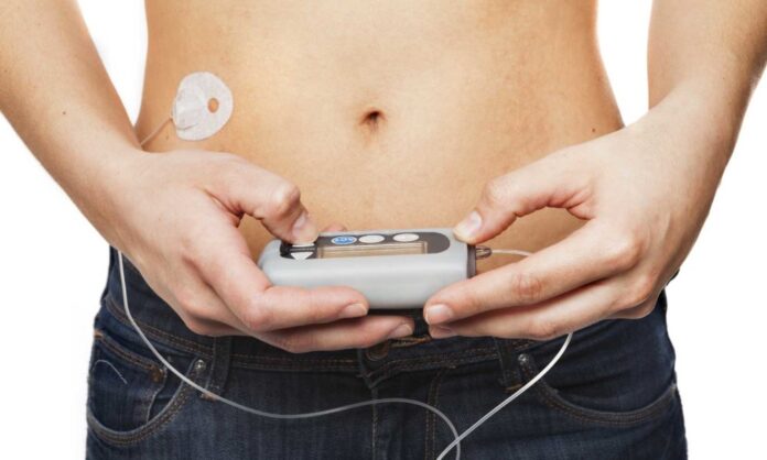 Insulin Pump Market-82c207eb