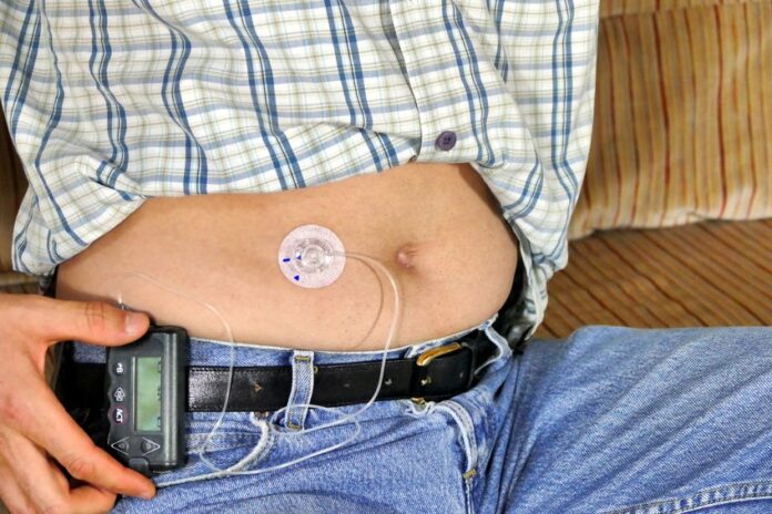 Insulin Pump Market-f6253c02