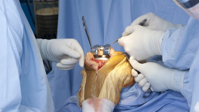 Knee Implants Market-1a275eee